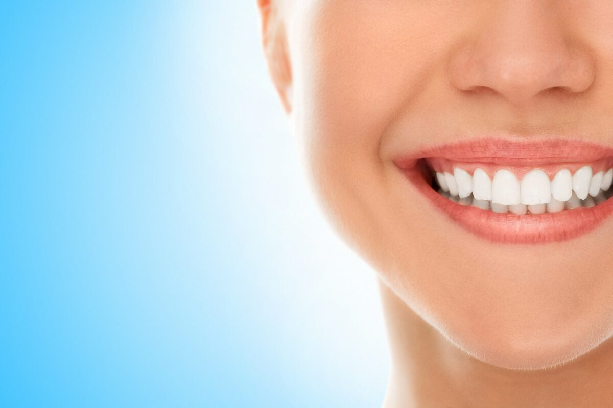 blanqueamiento dental duración