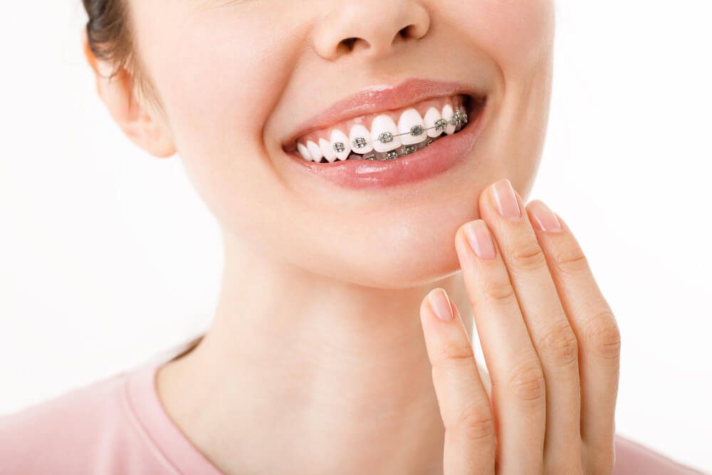 tratamiento de ortodoncia para bruxismo